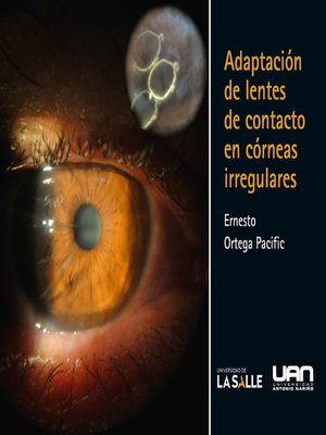 cover image of Adaptación de lentes de contacto en córneas irregulares